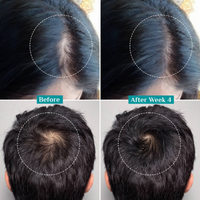 HairCTRL Redensyl + Rosemary Hair Growth Serum