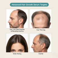 HairCTRL Redensyl + Rosemary Hair Growth Serum
