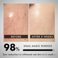 RepairCTRL Snail Mucin + Peptides Face Serum